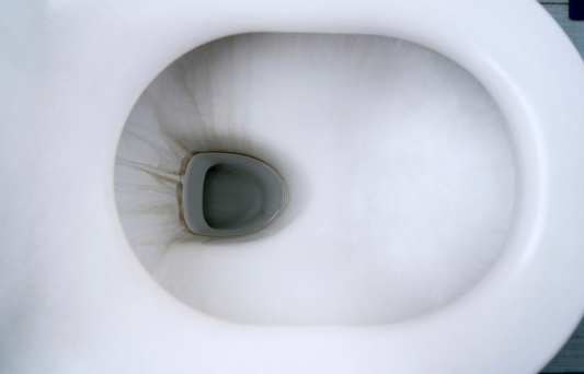 Cleaning Black Stains in Toilet Bowl