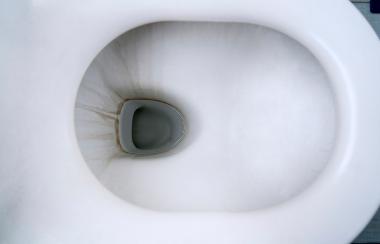 Cleaning Black Stains in Toilet Bowl